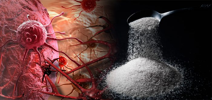 Understanding the Link Between Blood Sugar Levels and Prostate Cancer